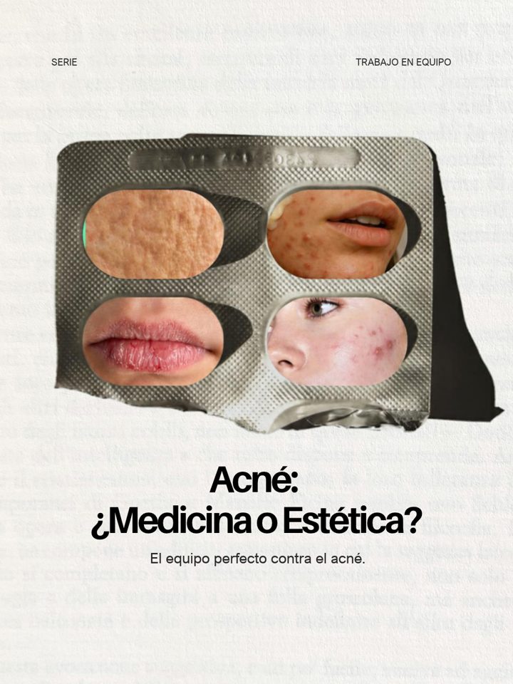 Post design: Acne, medicine or aesthetics?